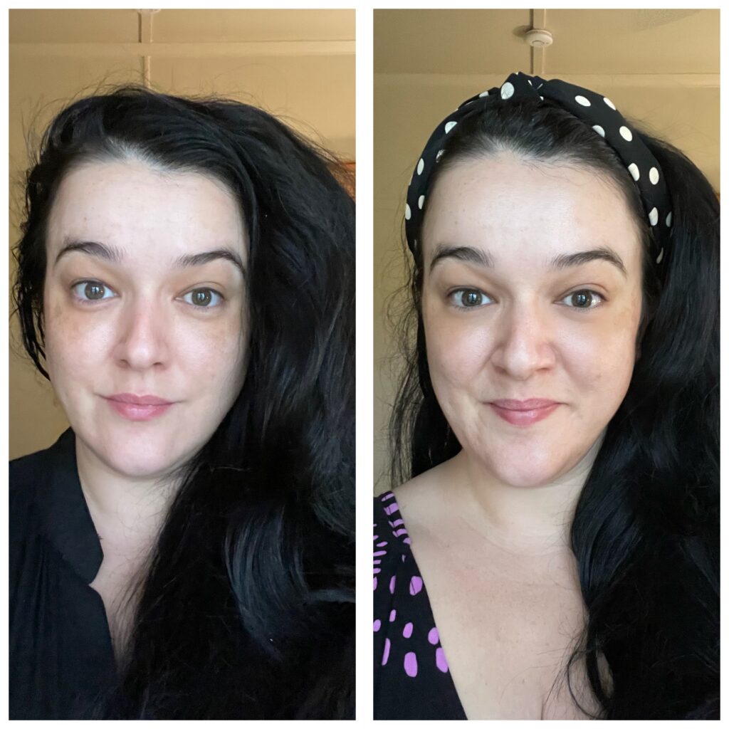 Before and after LED Light Therapy