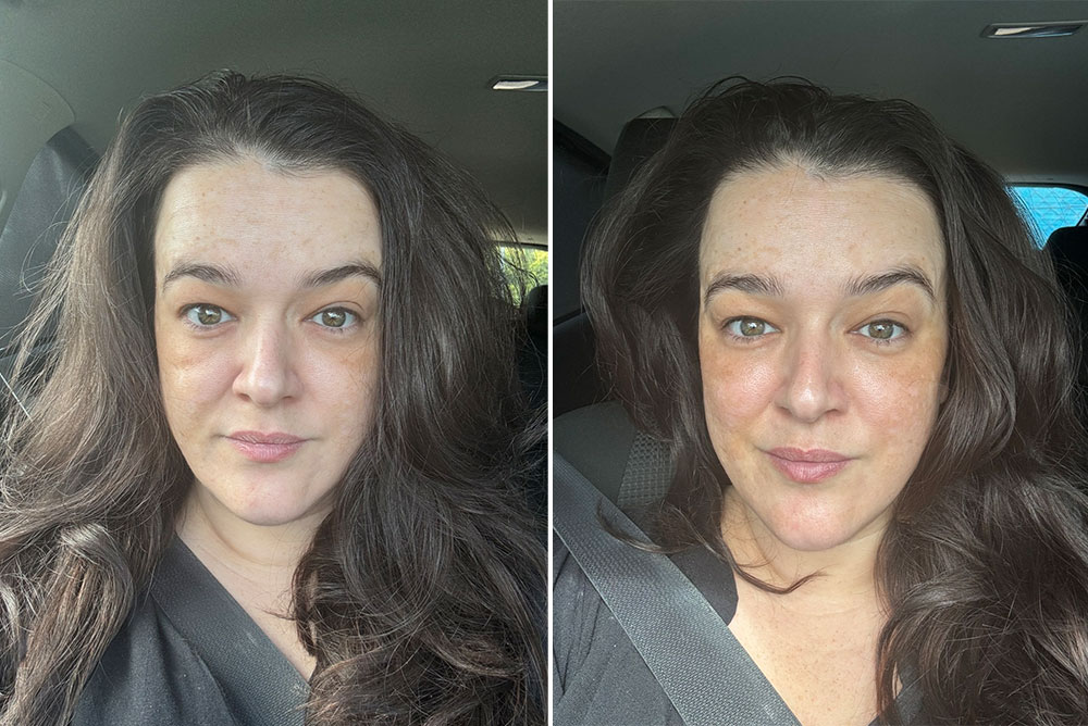 Two photos of the same brunette woman side by side. In the second picture her skin has more colour to it and looks more plump and rejuvenated. 