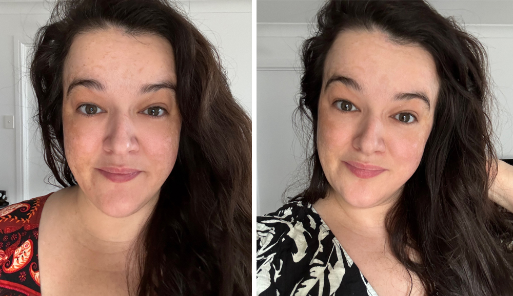 Before after clear skincare